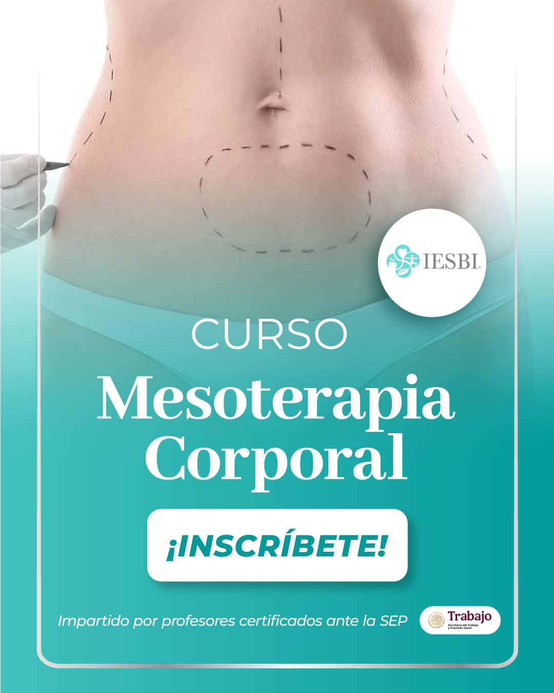 Mesoterapia corporal