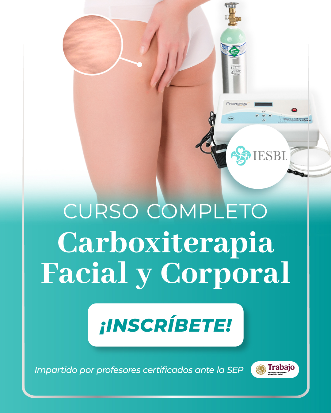 Curso completo de Carboxiterapia